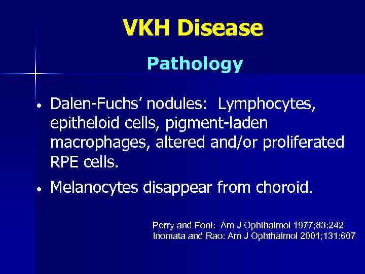 VKH Disease Pathology • Dalen-Fuchs’ nodules: Lymphocytes, epitheloid cells, pigment-laden macrophages, altered and/or proliferated