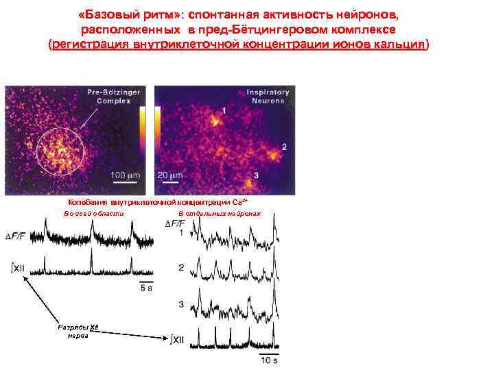  «Базовый ритм» : спонтанная активность нейронов, расположенных в пред-Бётцингеровом комплексе (регистрация внутриклеточной концентрации
