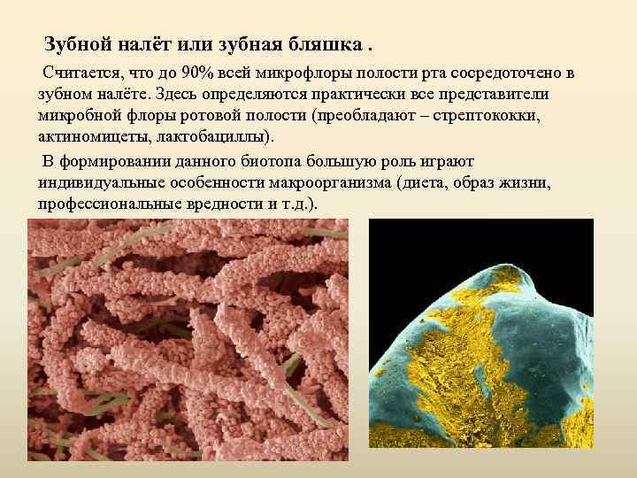 Зубной налёт или зубная бляшка. Считается, что до 90% всей микрофлоры полости рта сосредоточено