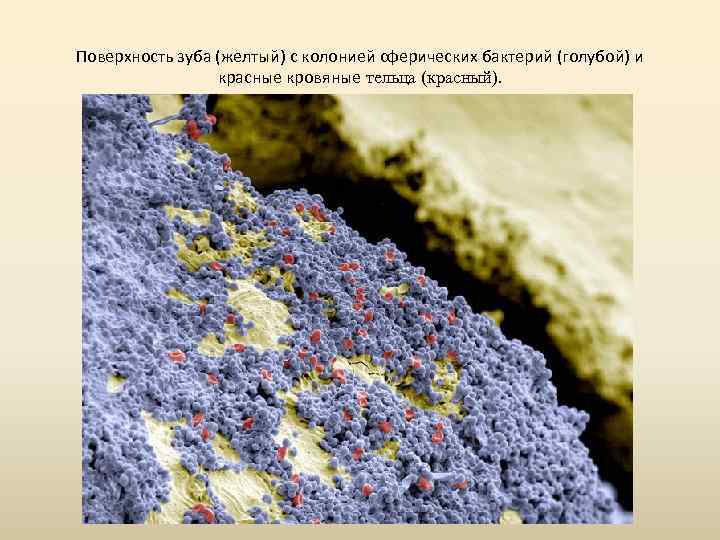 Поверхность зуба (желтый) с колонией сферических бактерий (голубой) и красные кровяные тельца (красный). 