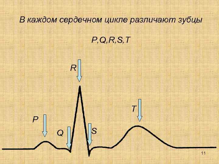 В каждом сердечном цикле различают зубцы P, Q, R, S, T R T P