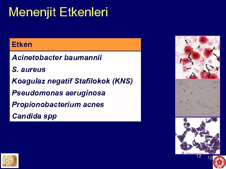 Menenjit Etkenleri Etken Acinetobacter baumannii S. aureus Koagulaz negatif Stafilokok (KNS) Pseudomonas aeruginosa Propionobacterium