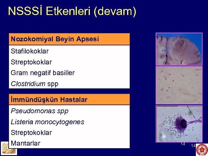 NSSSİ Etkenleri (devam) Nozokomiyal Beyin Apsesi Stafilokoklar Streptokoklar Gram negatif basiller Clostridium spp İmmündüşkün