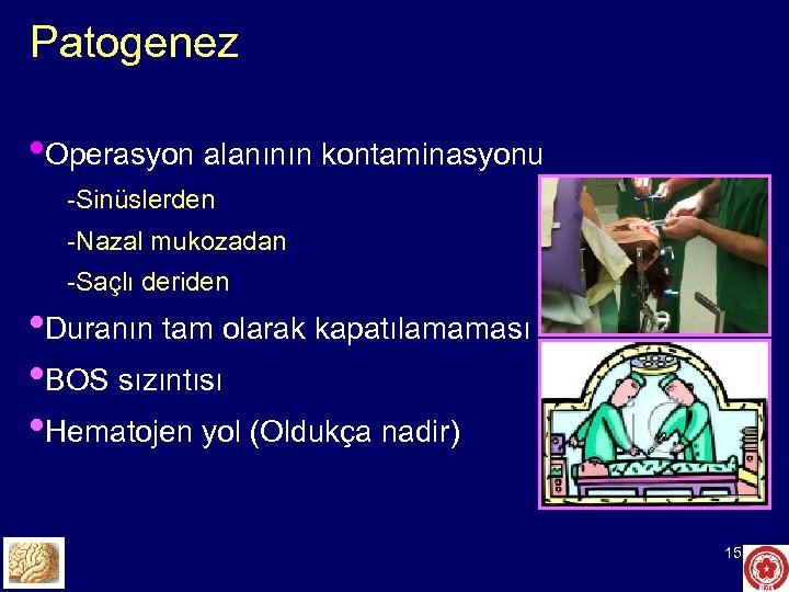 Patogenez • Operasyon alanının kontaminasyonu -Sinüslerden -Nazal mukozadan -Saçlı deriden • Duranın tam olarak