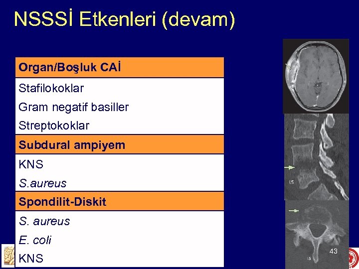 NSSSİ Etkenleri (devam) Organ/Boşluk CAİ Stafilokoklar Gram negatif basiller Streptokoklar Subdural ampiyem KNS S.