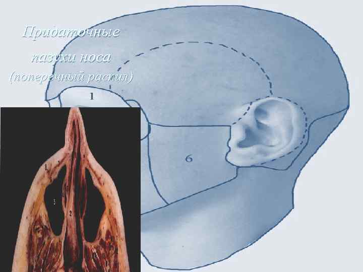Придаточные пазухи носа (поперечный распил) 