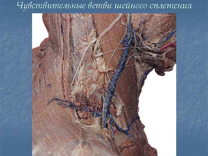 Чувствительные ветви шейного сплетения 