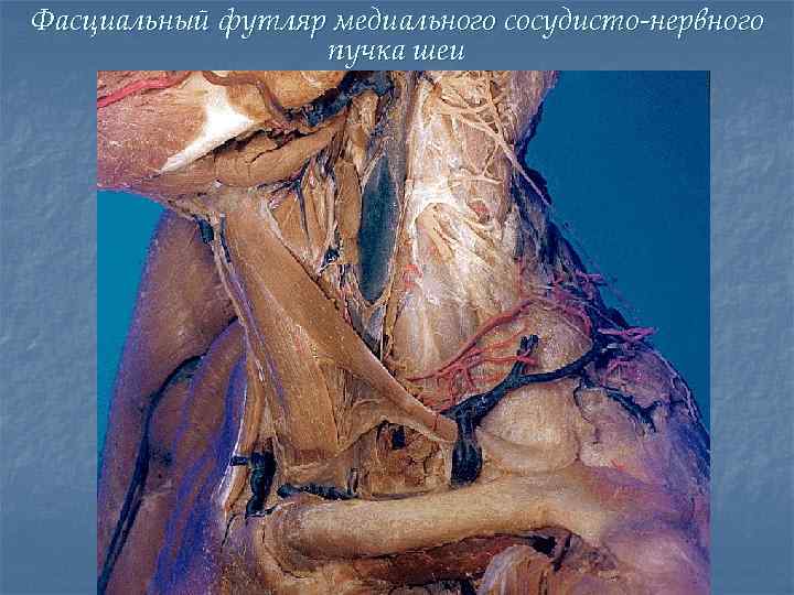 Фасциальный футляр медиального сосудисто-нервного пучка шеи 