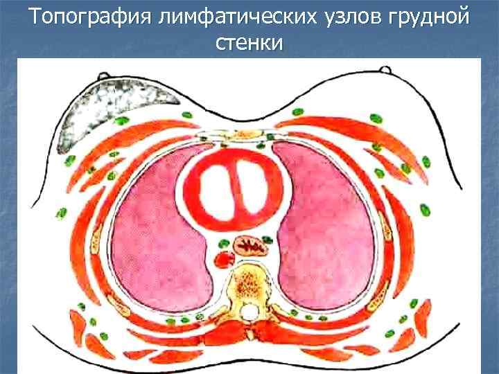 Топография лимфатических узлов грудной стенки 