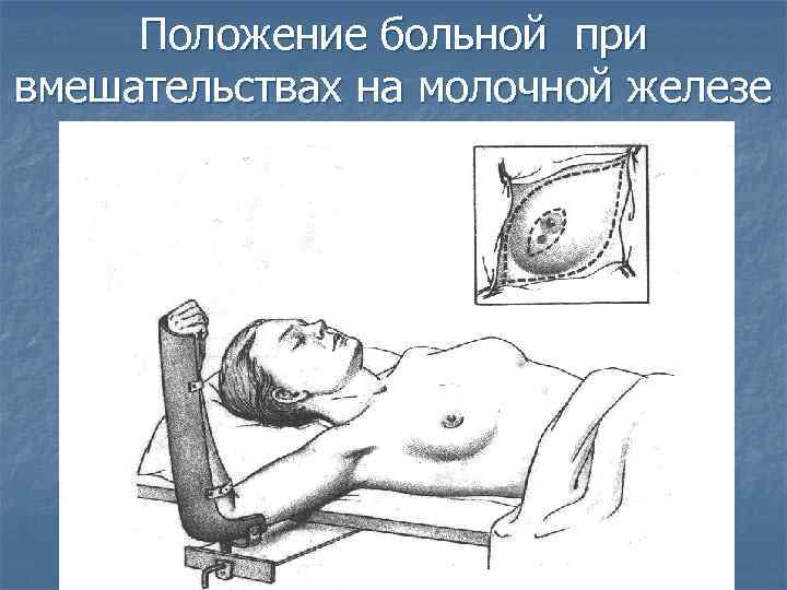 Положение больной при вмешательствах на молочной железе 