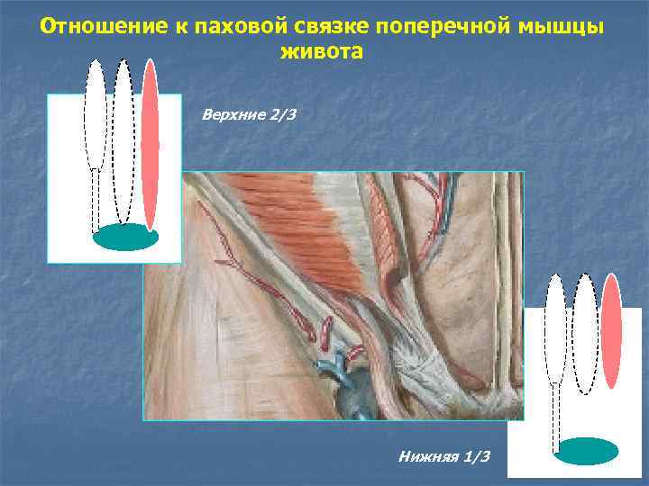 Отношение к паховой связке поперечной мышцы живота Верхние 2/3 Нижняя 1/3 