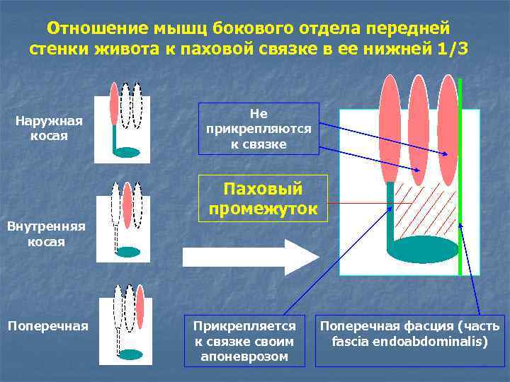 Отношение мышц бокового отдела передней стенки живота к паховой связке в ее нижней 1/3