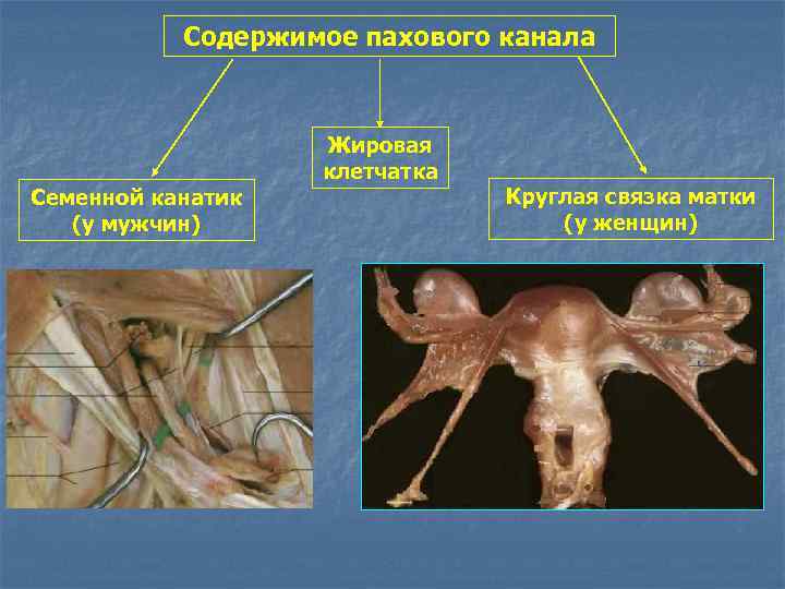 Паховая связка у мужчин фото