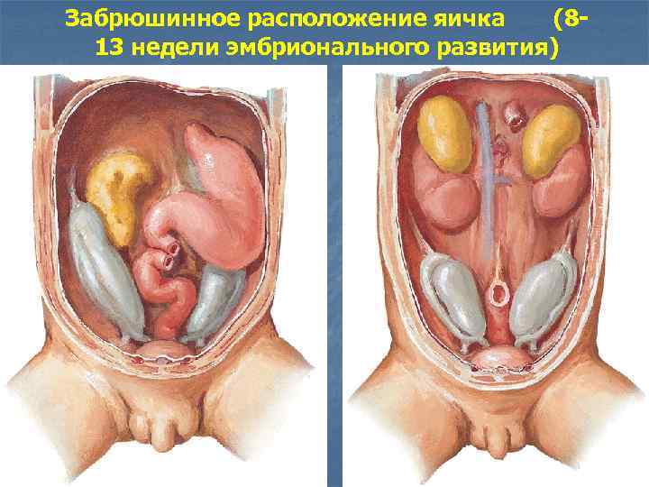 Забрюшинное расположение яичка (813 недели эмбрионального развития) 