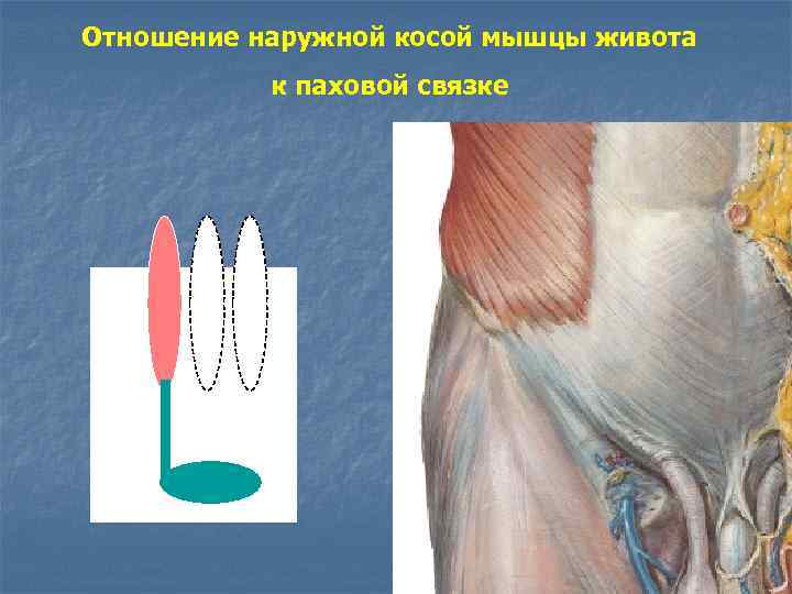 Мышцы брюшной стенки топографическая анатомия