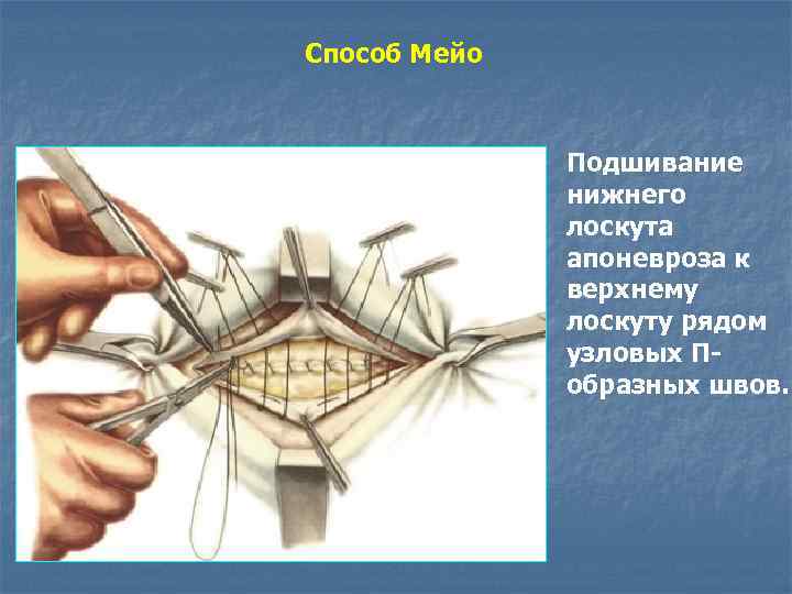 Мост мейо и остров бель карта