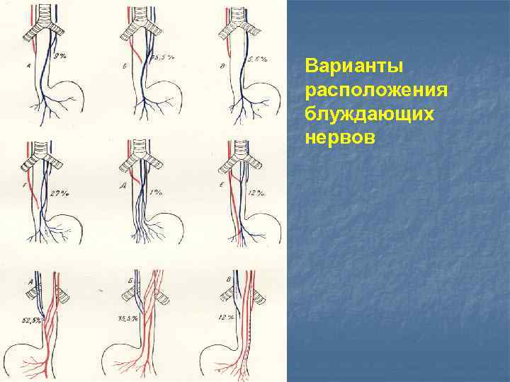 Варианты расположения блуждающих нервов 