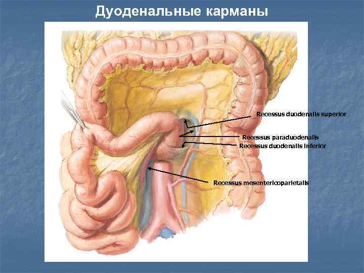 Дуоденальная связка