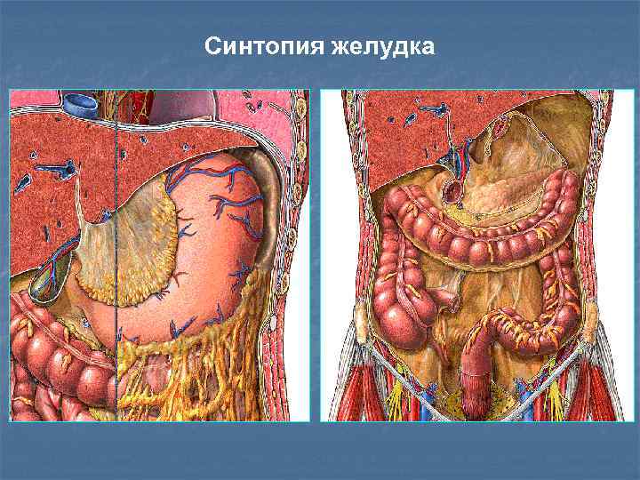 Синтопия желудка 