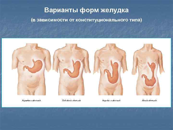 Варианты форм желудка (в зависимости от конституционального типа) 