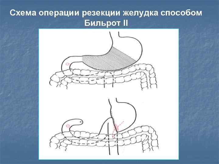 Схема операции