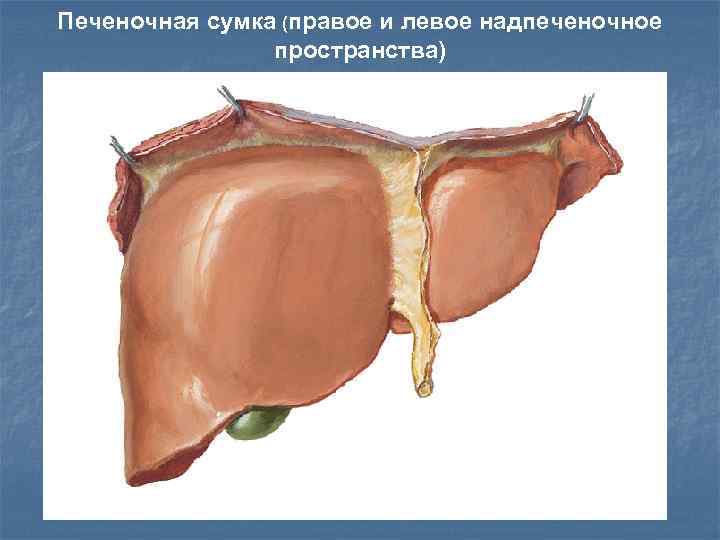 Печеночная сумка (правое и левое надпеченочное пространства) 