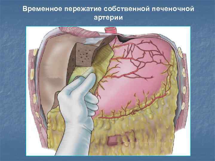 Малый сальник картинка