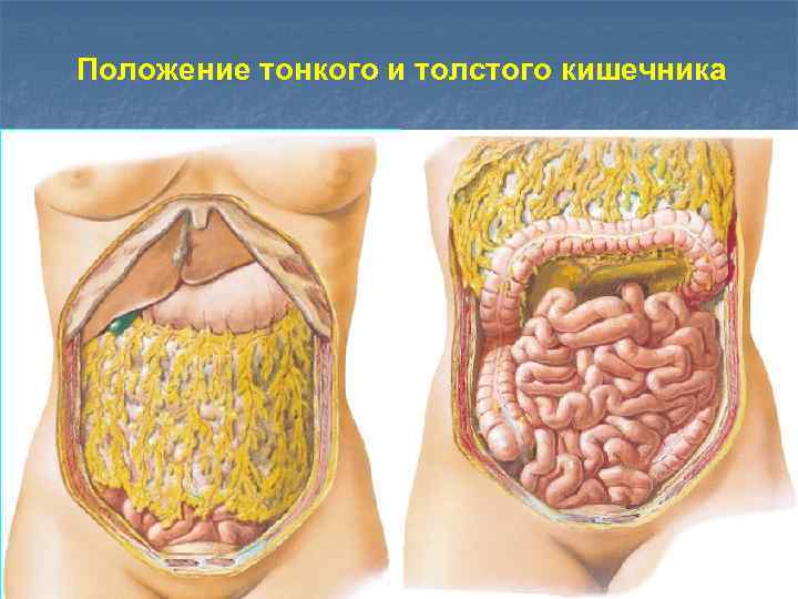 Положение тонкого и толстого кишечника 