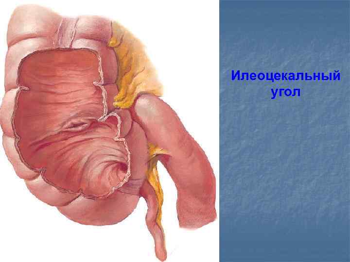 Илеоцекальный угол 