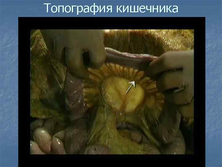 Топография кишечника 