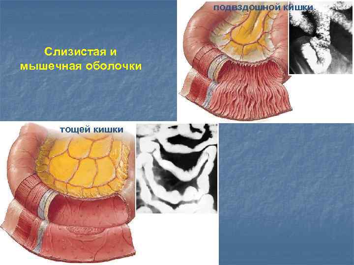 подвздошной кишки Слизистая и мышечная оболочки тощей кишки 