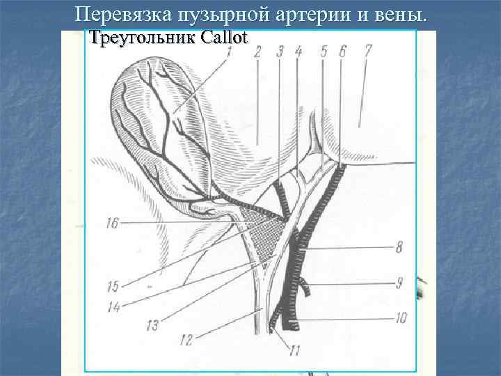 Треугольник кало схема