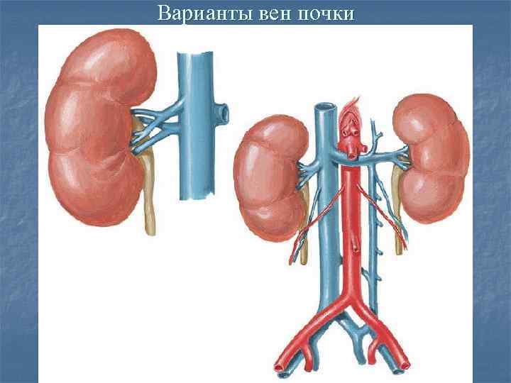 Правая и левая почка. Левая почечная Вена анатомия. Ретроаортальная почечная Вена. Кольцевидная Вена левой почки.