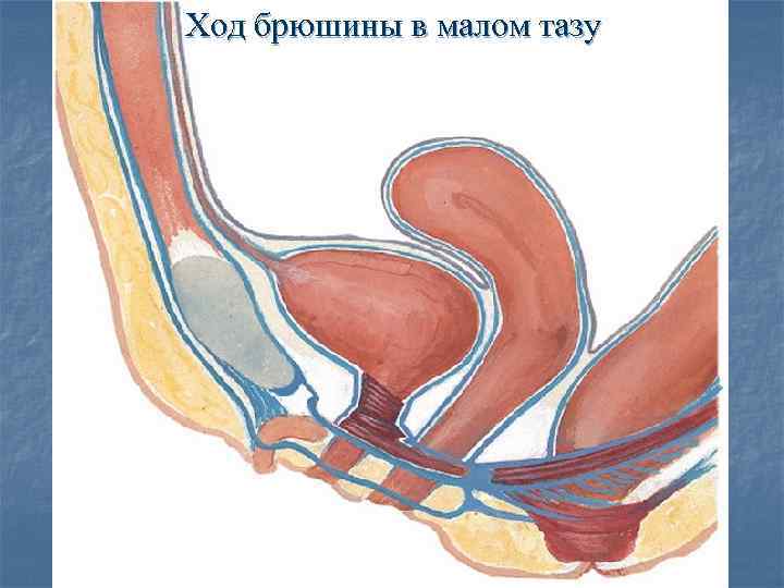 Брюшина малого таза у женщины на схеме фото