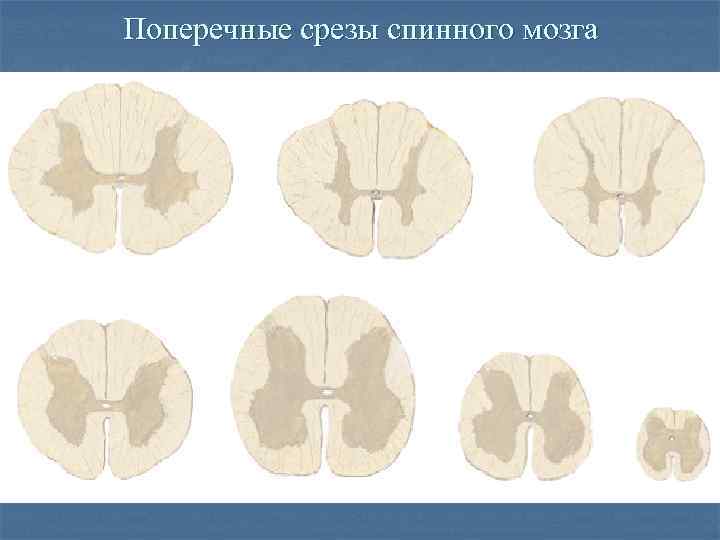 Поперечные срезы спинного мозга 