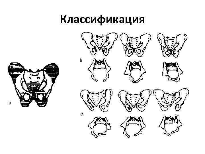 Классификация а с 