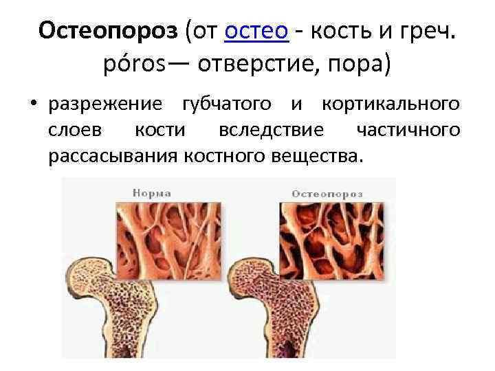 Кортикальная кость