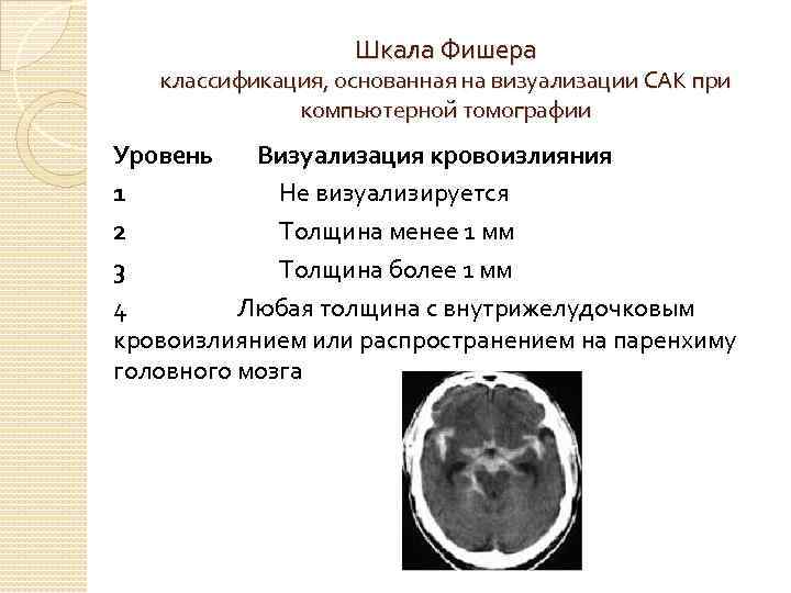 Шкала Фишера классификация, основанная на визуализации САК при компьютерной томографии Уровень Визуализация кровоизлияния 1