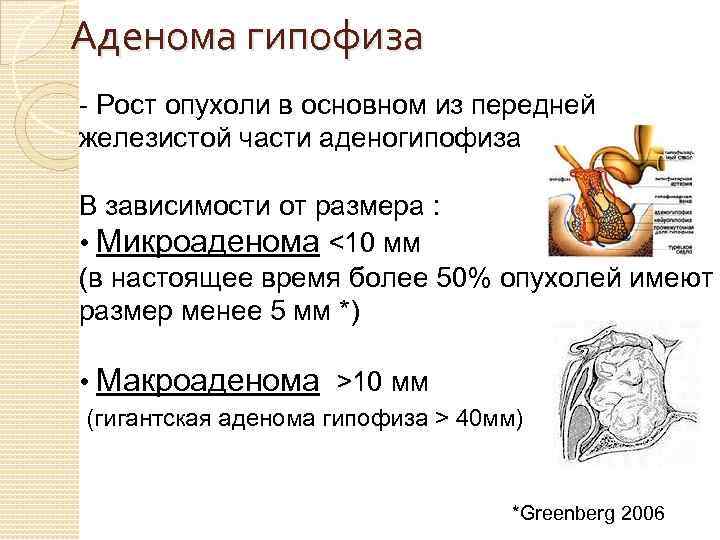 Микроаденома гипофиза. Аденома гипофиза мкб код 10 у взрослых. Микроаденома гипофиза мкб. Микроаденома гипофиза мкб 10. Микроаденома гипофиза код мкб.