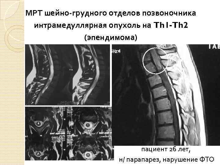 Мрт шейного отдела