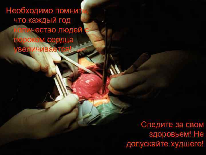 Необходимо помнить, что каждый год количество людей с пороком сердца увеличивается! Следите за свом