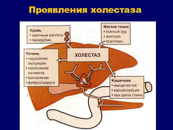 Проявления холестаза 