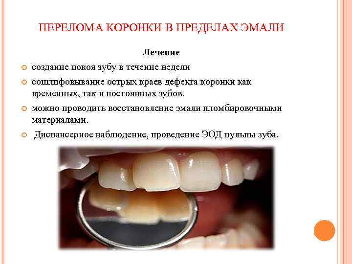 Перелом коронки зуба у детей thumbnail