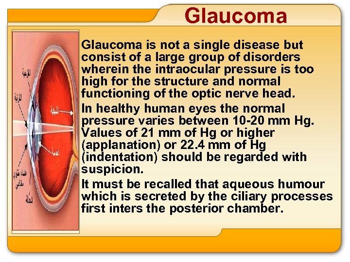 Glaucoma is not a single disease but consist of a large group of disorders