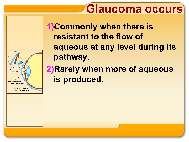Glaucoma occurs 1)Commonly when there is resistant to the flow of aqueous at any