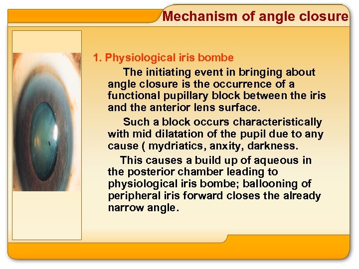Mechanism of angle closure 1. Physiological iris bombe The initiating event in bringing about
