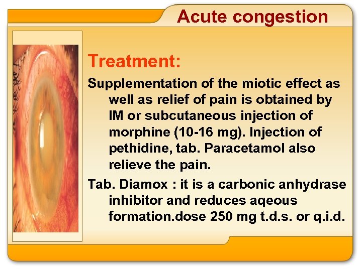 Acute congestion Treatment: Supplementation of the miotic effect as well as relief of pain