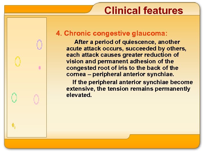 Clinical features 4. Chronic congestive glaucoma: After a period of quiescence, another acute attack