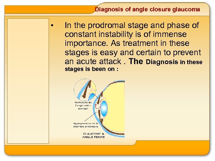 Diagnosis of angle closure glaucoma • In the prodromal stage and phase of constant