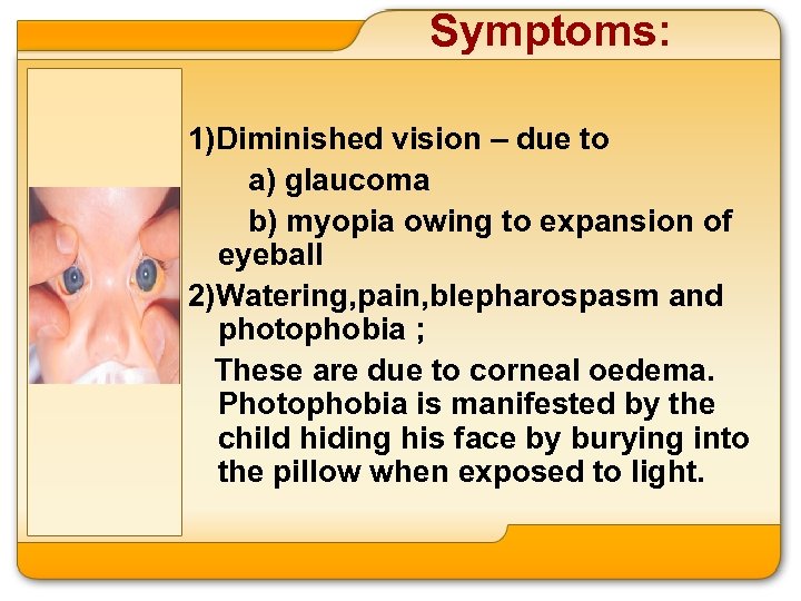 Symptoms: 1)Diminished vision – due to a) glaucoma b) myopia owing to expansion of